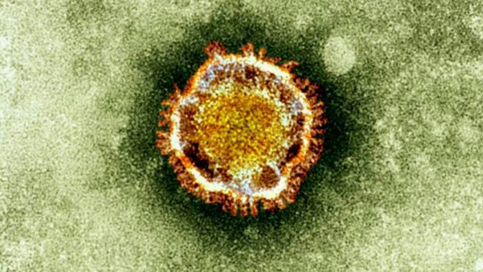 SARS Like Virus
