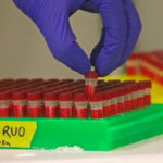 Experimental coronavirus drug remdesivir shows promise in Chicago trial, report says | USNN World News chicago hope