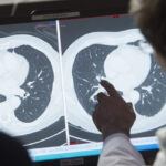 Big Pharma Paid $24 Million to 1% of US Oncologists, Many in High-Profile Positions: Study | USNN World News Big Pharma Paid $24 Million to 1% of US Oncologists, Many in High-Profile Positions: Study