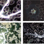 A Look Inside the COVID Vaccines and the Blood of the Vaccinated | USNN World News A Look Inside the COVID Vaccines and the Blood of the Vaccinated