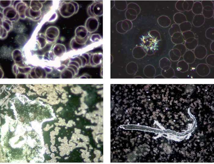 A Look Inside the COVID Vaccines and the Blood of the Vaccinated