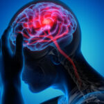 Booster Shots May Trigger Stroke Incidents, According to CDC and FDA | USNN World News Booster Shots May Trigger Stroke Incidents, According to CDC and FDA
