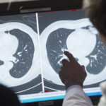 Parkinson’s Disease Linked to Very Common Chemical, Study Finds | USNN World News Parkinson’s Disease Linked to Very Common Chemical, Study Finds