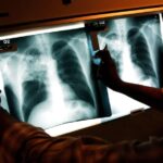 Illegal Immigrant Children With Tuberculosis Released Across US | USNN World News Illegal Immigrant Children With Tuberculosis Released Across US