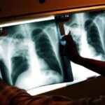 Hospital Notifies Hundreds of Patients of Possible Exposure to Highly Fatal Disease | USNN World News Hospital Notifies Hundreds of Patients of Possible Exposure to Highly Fatal Disease