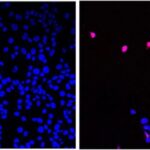 US Scientists Develop New ‘Cancer-Stopping Pill’ That Can ‘Annihilate’ Tumors, Leave Healthy Cells Unharmed