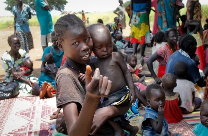 Over 1,200 Children Died of Suspected Measles Outbreak in War-Torn Sudan