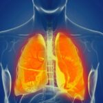 Poor Oral Health Speeds Up Irreversible Lung Disease: Study | USNN World News Poor Oral Health Speeds Up Irreversible Lung Disease: Study
