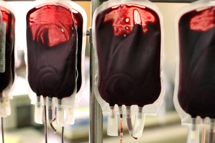 Researchers Concerned About Blood Transfusions From Vaccinated and Long-COVID Patients, Propose Changes