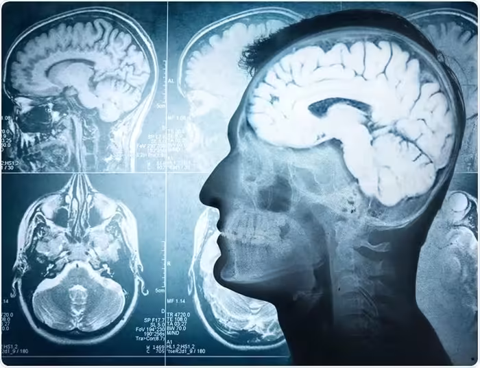 Brain Dead People May Not Be Dead–Here’s Why
