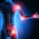 Understand Chronic Inflammation and 6 Ways To Reduce It 5 Understand Chronic Inflammation and 6 Ways To Reduce It