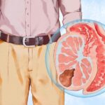 Testicular Cancer: Symptoms, Causes, Treatments, and Natural Approaches | USNN World News Testicular Cancer: Symptoms, Causes, Treatments, and Natural Approaches