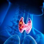 Thyroid Disorders: Natural Remedies and Treatment Options | USNN World News Thyroid Disorders: Natural Remedies and Treatment Options
