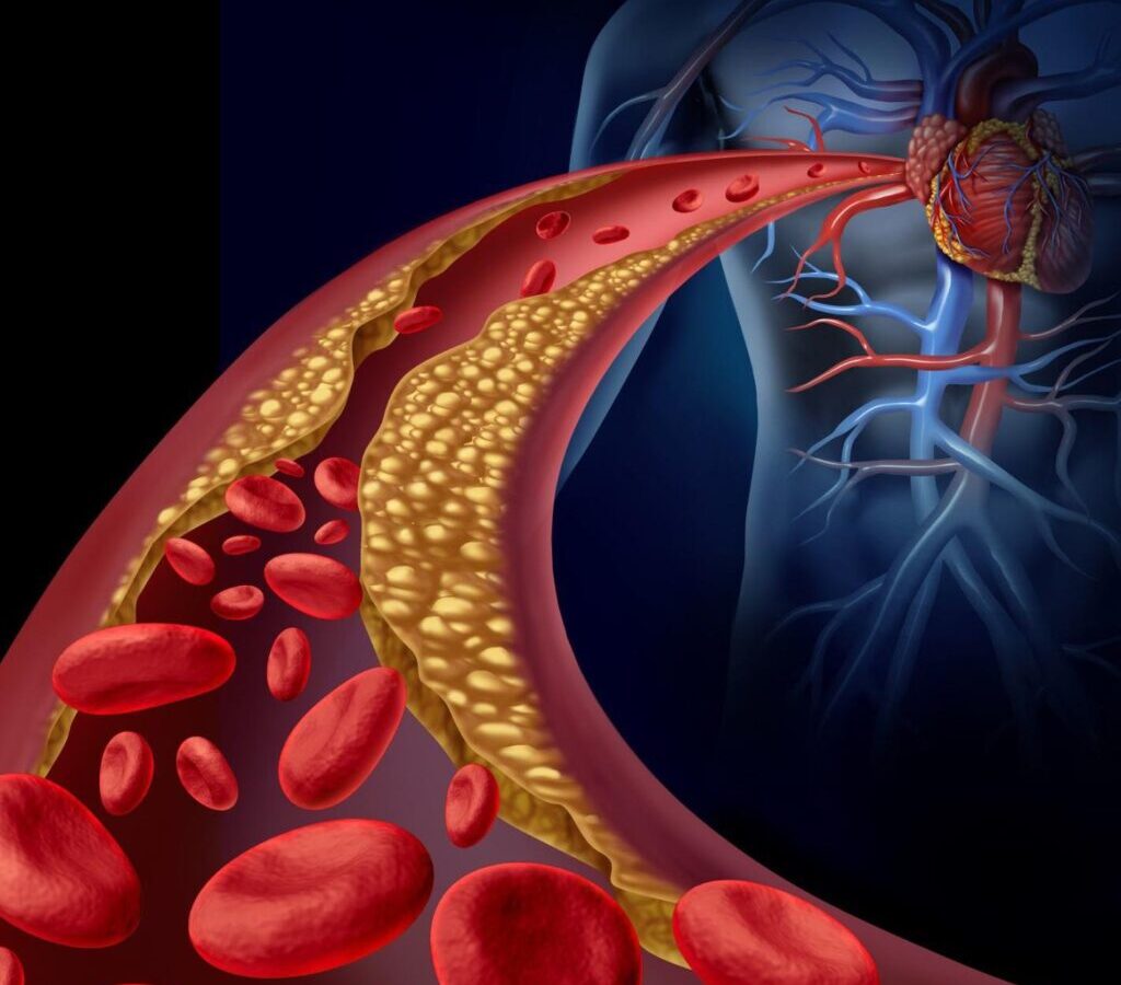 Cholesterol Could Boost Your Body’s Cancer-Fighting Abilities