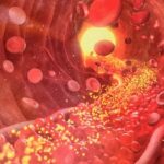 Beyond Cholesterol Lies a New Approach to Heart Health | USNN World News Beyond Cholesterol Lies a New Approach to Heart Health
