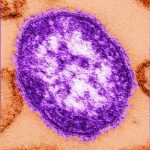 CDC Says Measles Cases Confirmed in 19 States This Year | USNN World News CDC Says Measles Cases Confirmed in 19 States This Year